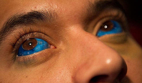 Tatouage cornée: changer la couleur des yeux est-il ...